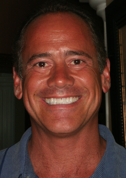 Smile gallery - Before & After photos - Dentistry @ Its Finest