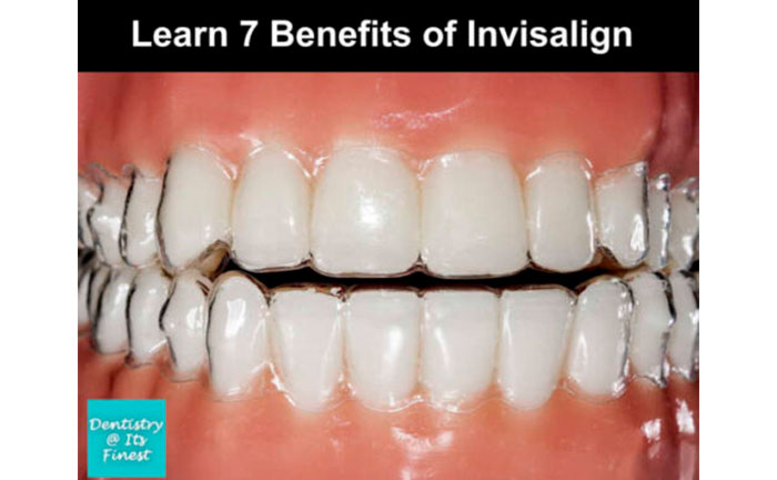 Invisalign Treatment