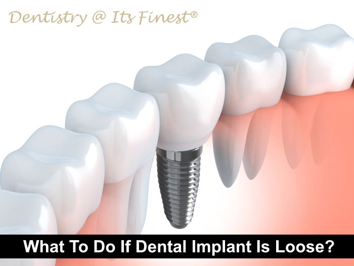 What Should You Do If Your Dental Implant Is Loose?