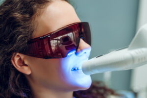 Zoom Whitening