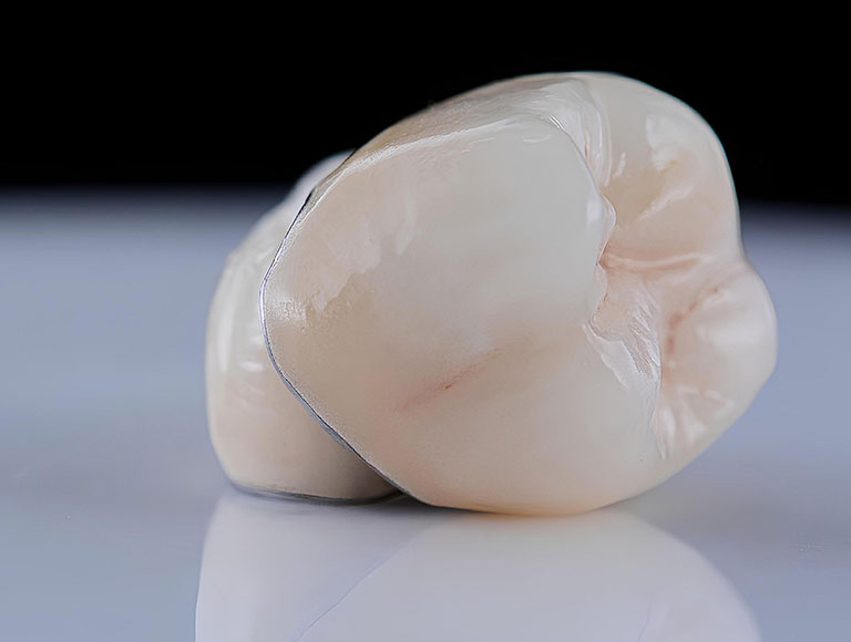 Dental Crown Cost