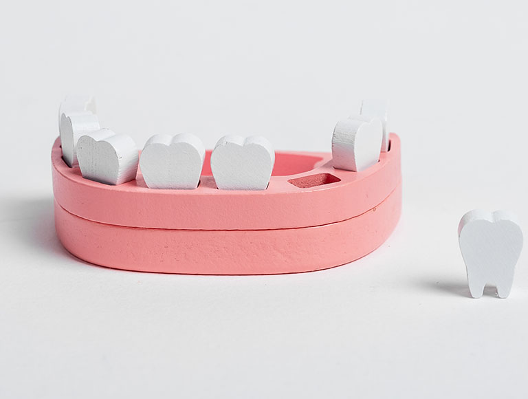 Missing Teeth Treatment