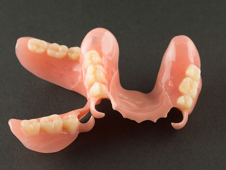What Are Partial Dentures?