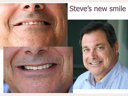Steve Asaro