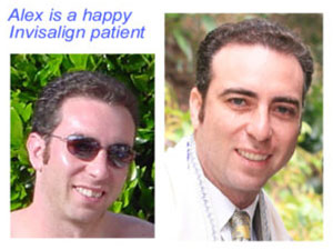 Alex G: Patient with Overbite correction