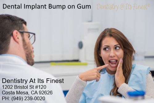 Dental implant bump gum