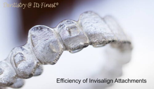Invisalign SmartForce