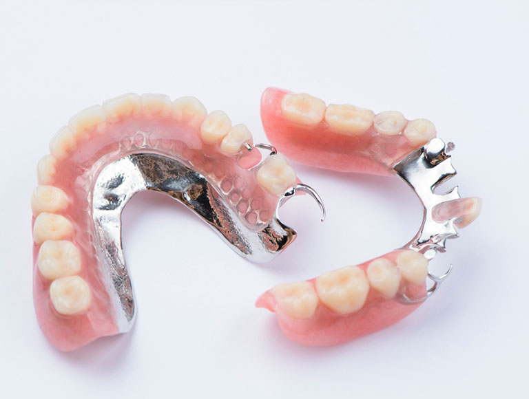 Partial dentures