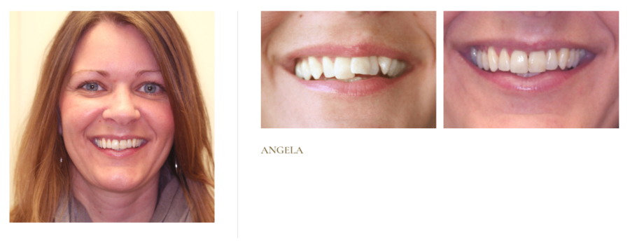 Angela