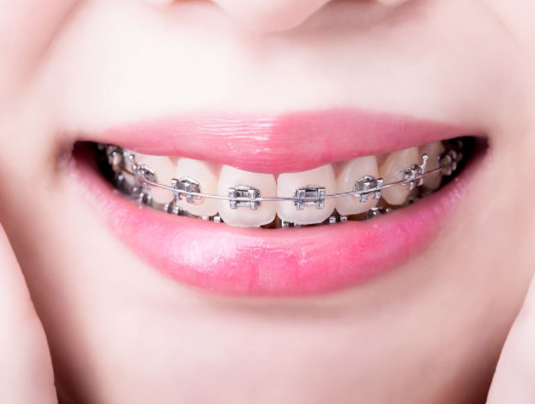 correct your bite at Dentistry At Its Finest in Irvine