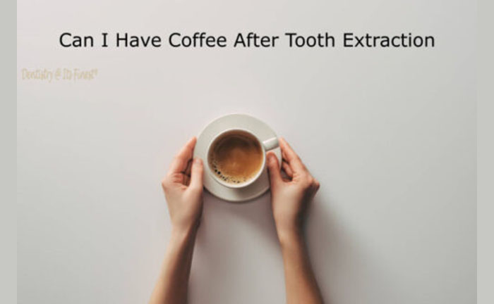 How Long After Root Canal Can I Drink Coffee: Expert Tips Revealed 6 How Long After Root Canal Can I Drink Coffee: Expert Tips Revealed