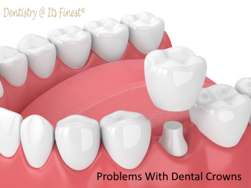 Problems with Dental Crowns