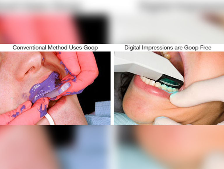 Conventional VS Digital