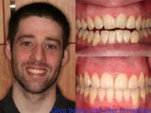 Craig P