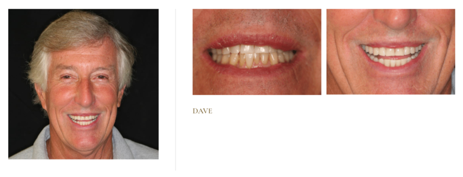Dave
