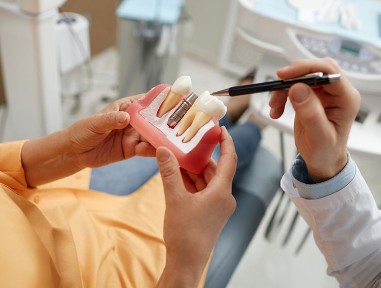 Implant Dentures Cost