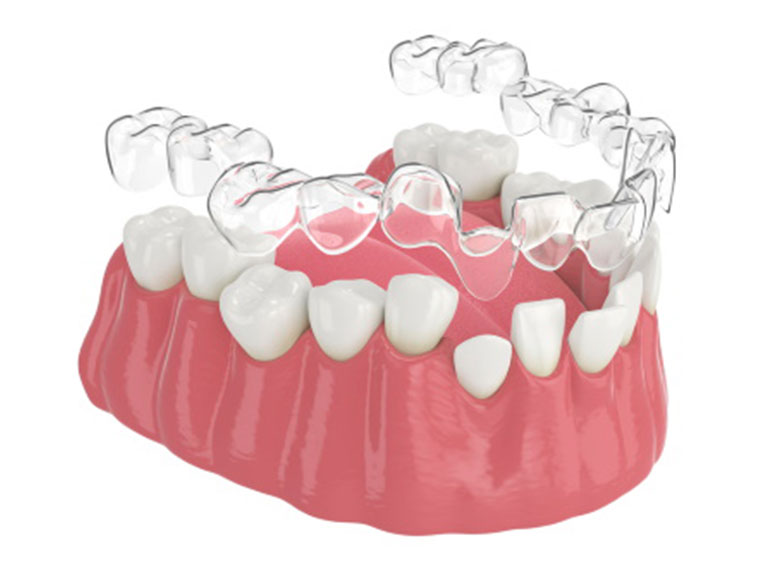 Beautiful New Smile Huntington Beach