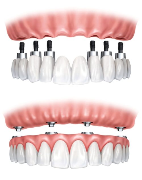 dental technology