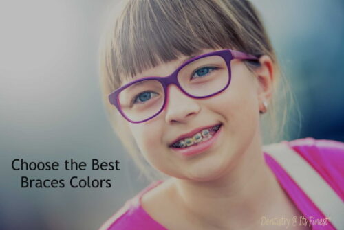Coose the Best Braces Colors