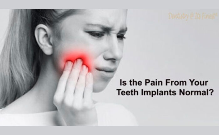Is the Pain From Your teeth Implants Normal?