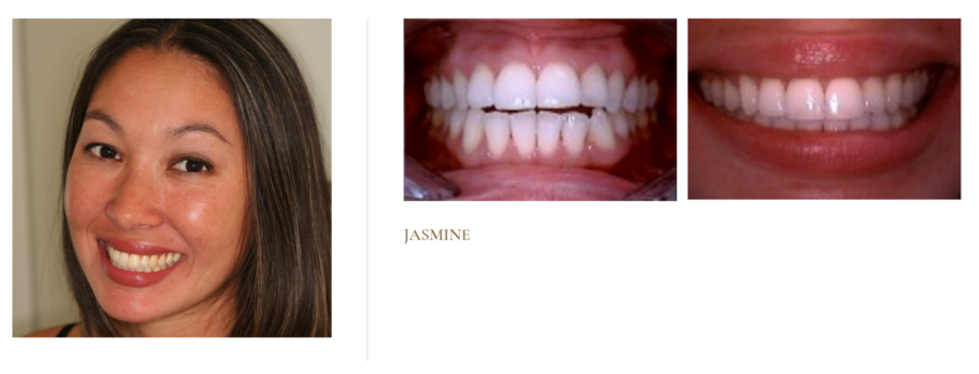 Jasmine