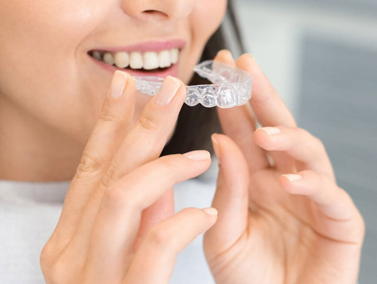 Clear Aligners for Orange County Community