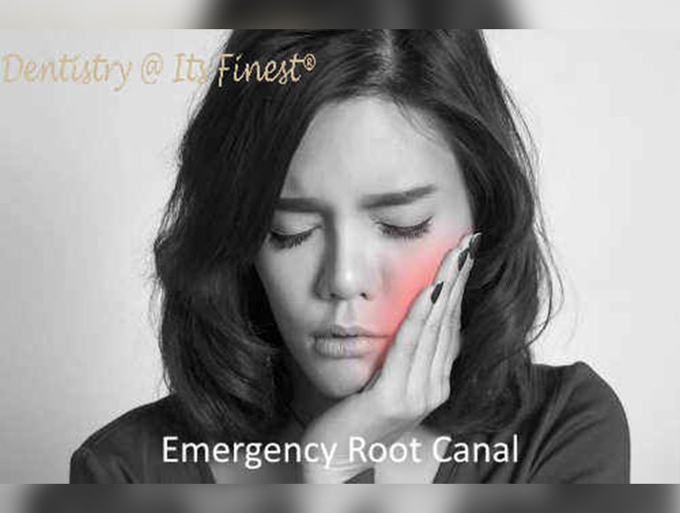 Emergency Root Canal in Costa Mesa