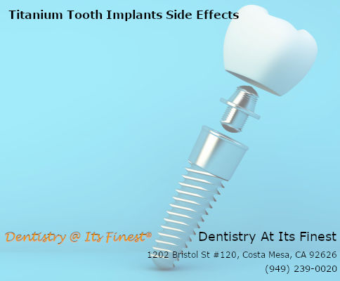 Titanium dental implant side effects