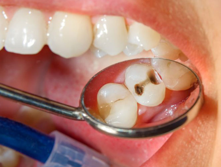What do different types of toothaches feel like?