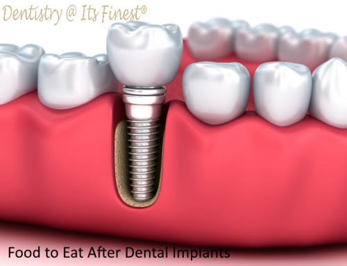 Food to Eat After Dental Implants