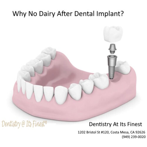 Why no dairy after dental implant