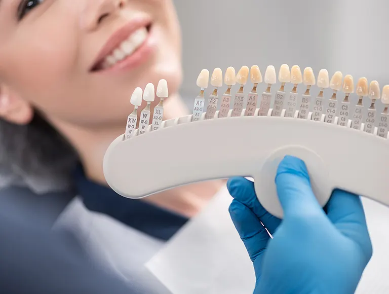 Veneers Cost in Orange County