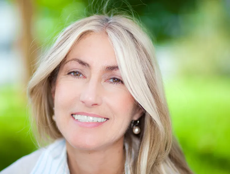 Orange County Dental veneer
