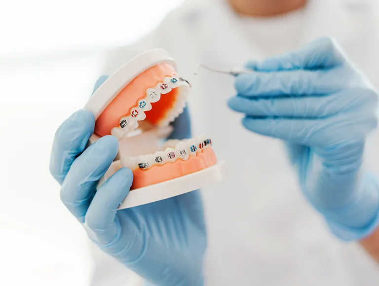 Children orthodontics in Irvine