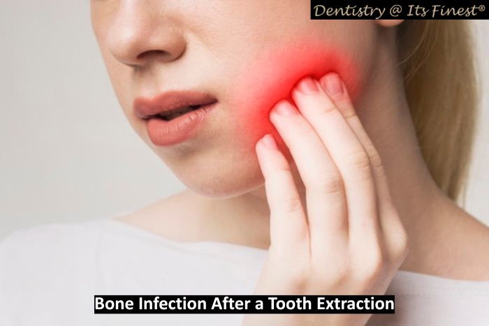 Bone Infection After a Tooth Extraction