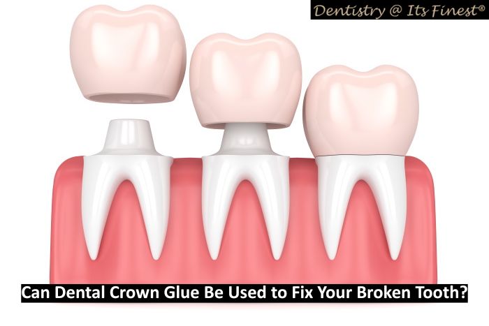 Prevest Micron Dental Cement – Permanent Crown & Bridge Repair Kit (Natural Shade, Powder/Liquid)