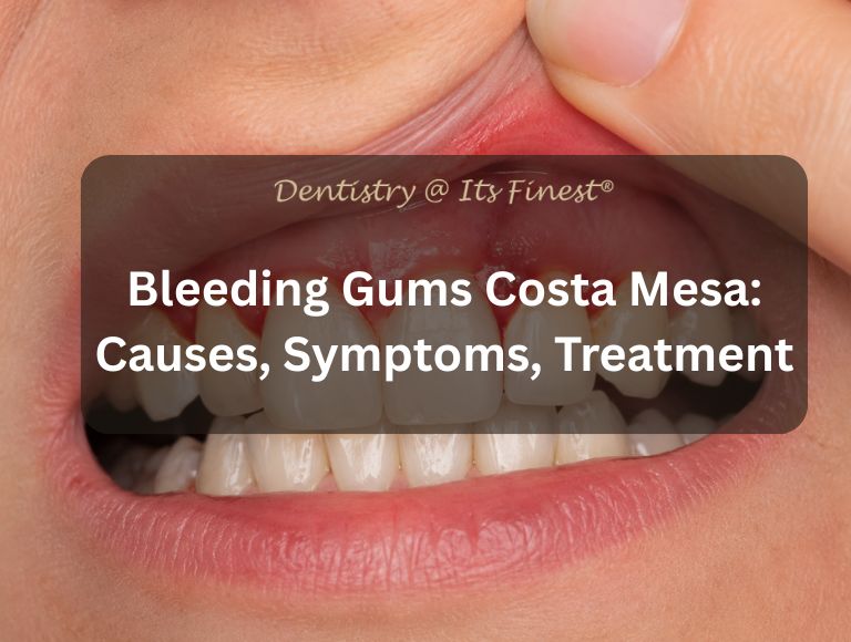 Bleeding Gums Costa Mesa