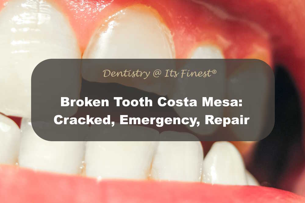Broken Tooth Costa Mesa