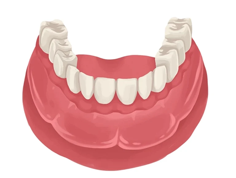 Full-dentures
